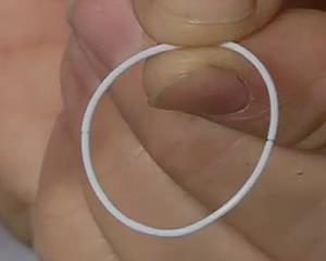 Glaucoma Ring